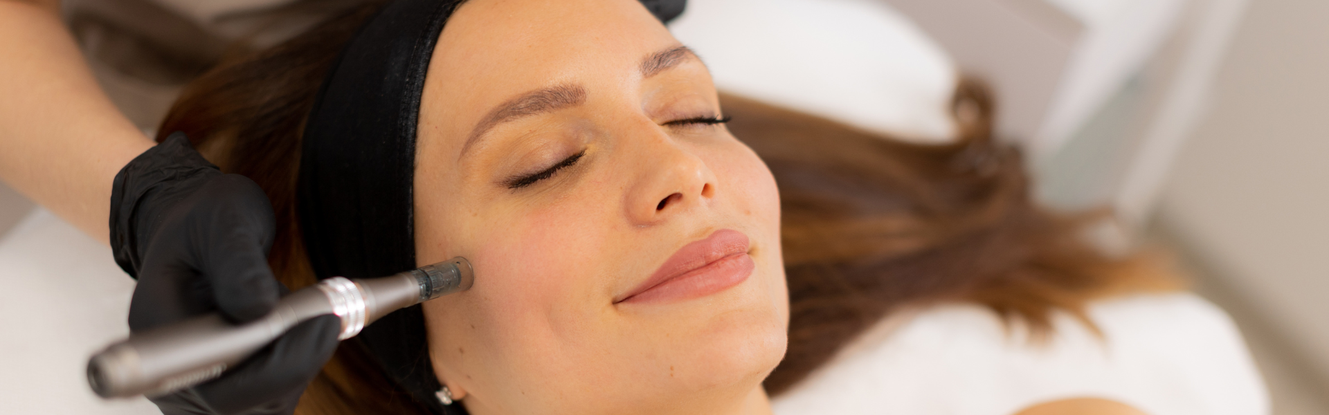 Hair Transplant