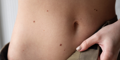 Moles